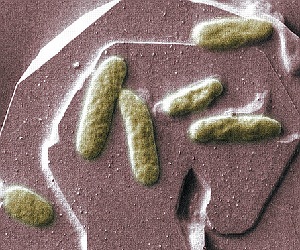 Bakterien auf Mineral: potenzielle Stromquelle (Foto: PNNL, Alice Dohnalkova)