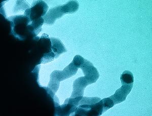 Leukämie: ein Chromatin unter dem Mikroskop (Foto: Biology Pics/SPL)