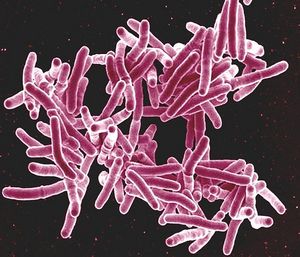 Tuberkulose-Bakterien: Bei Kindern schwer erkennbar (Foto: flickr.com/NIAID)