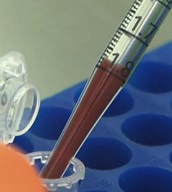 Pipette mit Blut: Forscher entwickeln neuen Impfstoff (Foto: sanger.ac.uk)