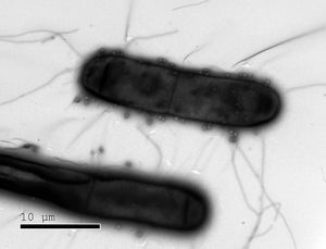 Bakterien, auf denen die viel kleineren Phagen sitzen (Bild: weizmann.ac.il)