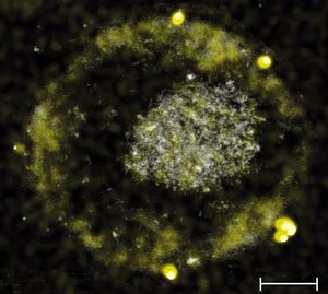 Bakterium C. metallidurans bildet winzig kleine Gold-Nuggets (Foto: asm.org)