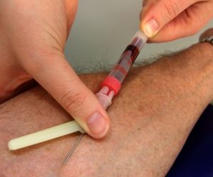 Blutentnahme: schnelles Handeln bei Sepsis (Foto: pixelio.de, RainerSturm)