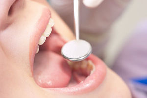 Schiefe Zähne bringen Schmerzen