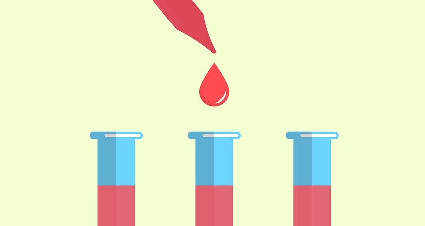Krebs: Optik-Biosensor liefert frühe Diagnose