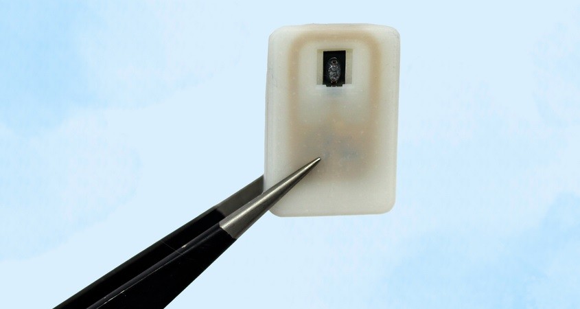 Implantat des MIT rettet Diabetes-Patienten