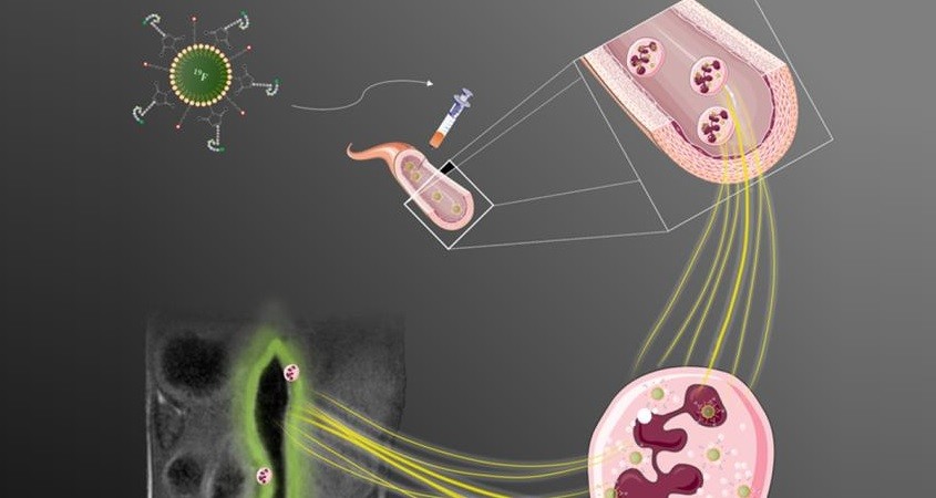 Wissenschaftler halten Neutrophile im Zaum