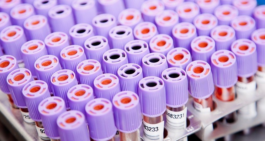 PSA-Tests haben sich in England verfünffacht