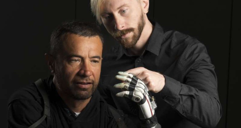 Neue Hightech-Handprothese greift intuitiv zu