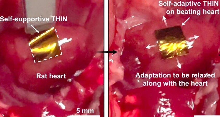 Hauchdünne Folie erfasst Signale des Herzens