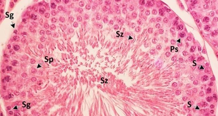 Chemo-Kombitherapie schützt die Fruchtbarkeit