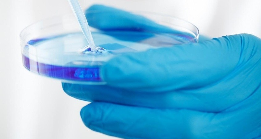 Speichel verrät viele neurologische Störungen