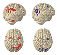 Neuroimaging Aufnahme (Foto: Impact Assessment of Neuroimaging)