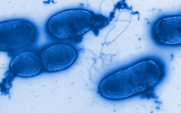 Pseudomonas aeruginosa Bakterien sind gesundheitsschädigend (Foto: gbf.de)