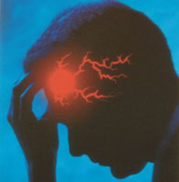 Migräne: bei mehr als ein Drittel der Patienten nicht diagnostiziert (Foto: handicap-network.de)