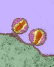 HI-Virus attackiert menschliche Zellen (Foto: Dr. Klaus Boller / Science Photo Library)