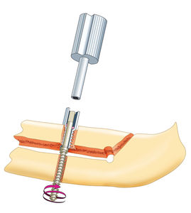 Schematic representation (1)