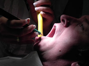 EMDR-Therapie gegen die Angst vor dem Zahnarzt (Foto: pixelio.de)