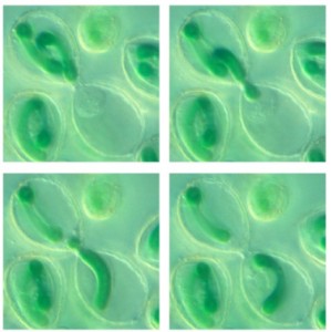 Die Amöbe als Zwischenschritt bei der Entwicklung der Photosynthese der Pflanzen (Foto: E. Nowack) Die Amöbe als Zwischenschritt bei der Entwicklung der Photosynthese der Pflanzen (Foto: E. Nowack)