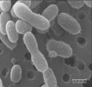 Chryseobacterium greenlandensis unter dem Elektronenmikroskop betrachtet (Foto: J. Loveland-Curtze)
