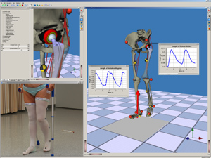 Bewegungsanalyse und Prothesenplanung mit 3D-Visualisierung (Foto: LMR)