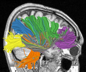 Die Verkabelung des Gehirns soll Vomputer-Vorbild werden (Foto: IBM)