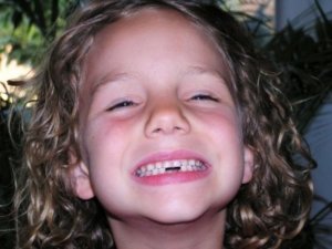 Verlorene Zähne könnten in Zukunft auch bei Erwachsenen nachwachsen (Foto: pixelio.de/Dippold)