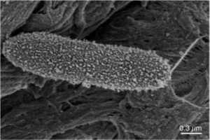 Nach Kontakt mit dem Eiweiß verändert sich Oberfläche des Bakteriums (Foto: Univ. Brit. Columbia)