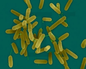 Pseudomonas aeroginosagehört zu den resistenten Keimen (Foto: Journal Clinical Microbiology)