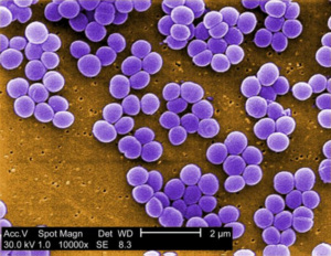 Krankenhauserreger Staphylococcus aureus (Foto: Janice Haney Carr, phil.cdc.gov)