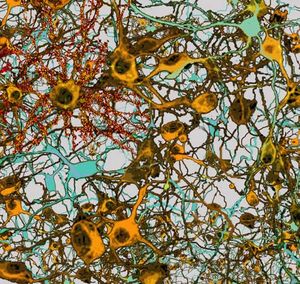 Neuronen mit tausenden Synapsen. Schlüssel zu lernfähigeren Computern (Foto: TU Graz/IGI)