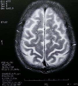 Ultraschall ist für Neurologen immer öfter eine Alternative zu MRT (Bild) (Foto: pixelio.de/Schütz)