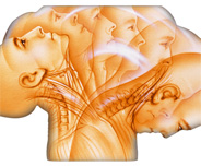 Schleudertrauma