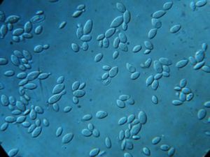 Nützliche Mikroorganismen: Vereinfachte Zulassung soll bleiben (Foto: bio-ferm.com)
