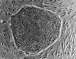 Embryonale Stammzelle: Durch pluripotente Stammzellen nicht mehr nötig (Foto: Wikimedia Commons)