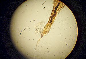 Larve der Anopheles-Mücke: Malaria tötet jährlich eine Mio. Menschen (Foto: FlickrCC/prep4md)