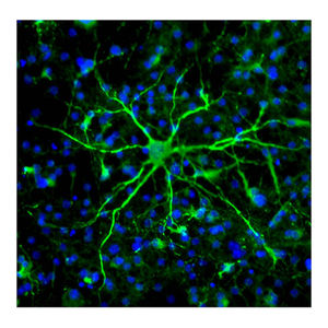 Vorläuferzellen: Antidepressiva erweisen sich als produktiv (Foto: grad.ucl.ac.uk)