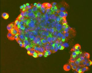 Stammzellen: Patent-Verbot hätte gravierende Folgen (Foto: http://pharmas.co.uk)