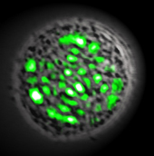 Zelle: Lebendiges erzeugt Laserstrahl (Foto: massgeneral.org)