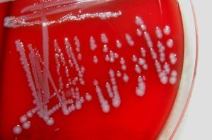 Bakterienkultur: Immunsystem muss sich anstrengen (Foto: aboutpixel.de/Ute Pelz)