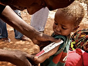 Unternernährtes Kind: Ohne Langzeithilfe keine Zukunft (Foto: FlickrCC/Crowley)