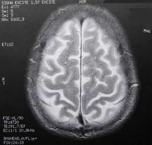 Gehirn-Scan: Forscher untersuchen Belohnungsprozesse (Foto: pixelio.de, Schütz) Gehirn-Scan: Forscher untersuchen Belohnungsprozesse (Foto: pixelio.de, Schütz)
