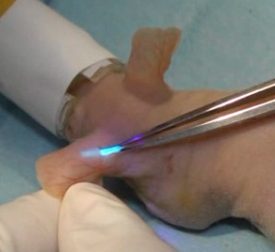 Glukose-Sensor: Glüht bei Anstieg des Blutzuckerwerts (Foto: Uni Tokio)