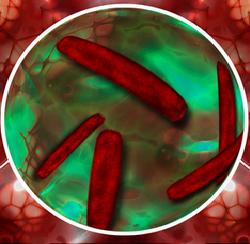 Krankheiten: Soziale Netzwerke als Feind (Foto: pixelio.de, Gerd Altmann)