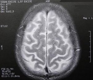 Gehirn-Scan: Stammzellen-Tests gehen weiter (Foto: pixelio.de, Dieter Schütz)