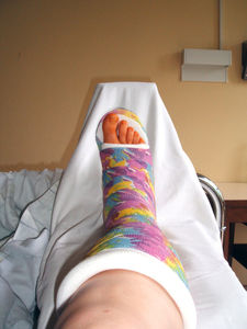 Gips: Gesetzliche Krankenkassen mit Überschüssen (Foto: pixelio.de/Ute Pelz) Gips: Gesetzliche Krankenkassen mit Überschüssen (Foto: pixelio.de/Ute Pelz)