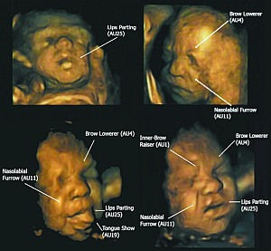 Ungeborene im 4D-Ultraschall: Erste Mimik bereits sichtbar (Foto: Reissland)