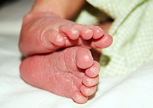 Neugeborenes: Kritische Zeit für Schmerzwahrnehmung (Foto: FlickrCC/Surfgirl)