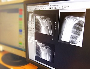 Röntgenbilder am Computer: IT krempelt die Medizin um (Foto: pixelio.de/Sturm)