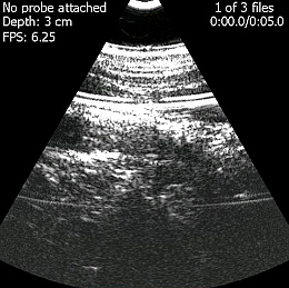 Ultraschall: MobiUS macht stationäres Gerät transportabel (Foto: mobisante.com) Ultraschall: MobiUS macht stationäres Gerät transportabel (Foto: mobisante.com)